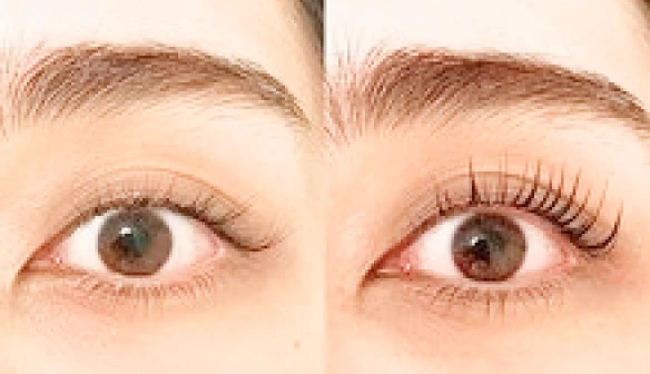 パリジェンヌ施術前後